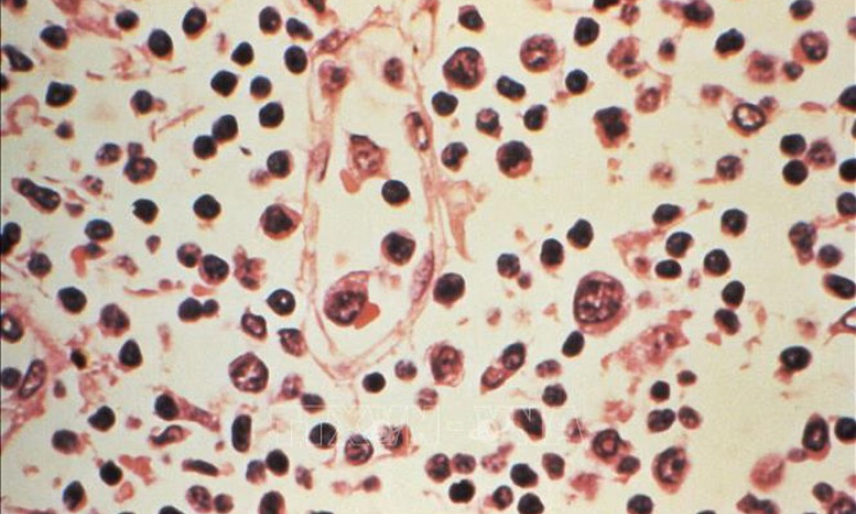 Virus Hanta: X&aacute;c nhận 6 ca nhiễm, nguy cơ l&acirc;y lan to&agrave;n cầu ở mức thấp